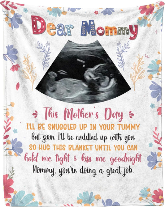 Custom Sonogram Photo Blanket - Personalized Gift for New Mom Mother's Day, Ultrasound Picture Throw for Expecting Mom, Pregnancy Announcement Keepsake Phot Blanket (Style 02)